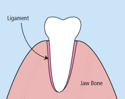 Illustration of a Tooth Extraction