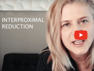 interproximal reduction from Premier Orthodontics & Dental Specialists